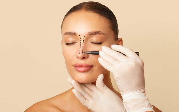 Rhinoplasty Guide: What to Know Before, During, and After
